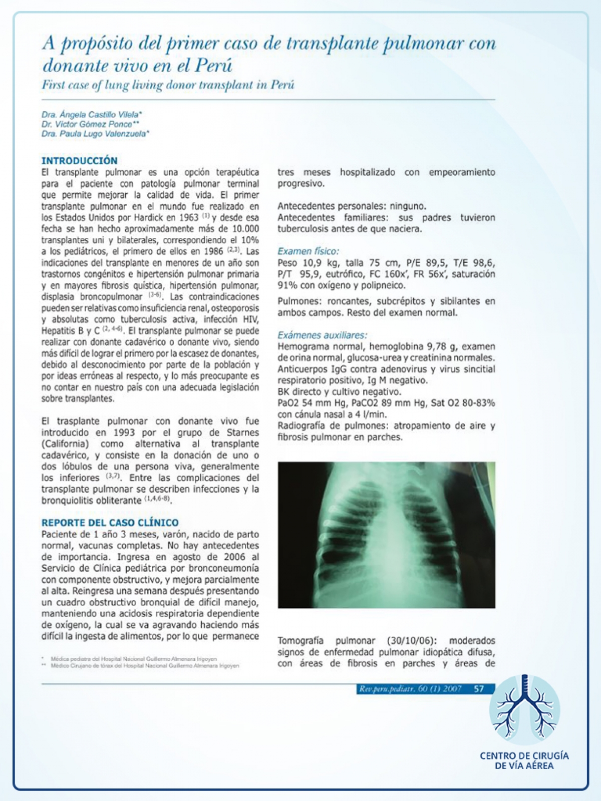 Cáncer de pulmón